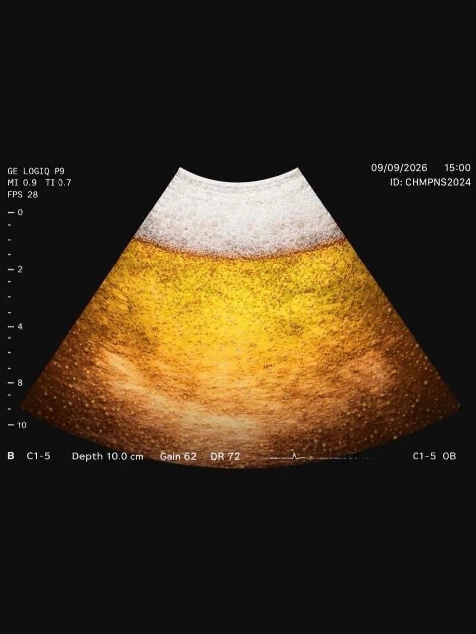 УЗИ пятницы🍺🤪 - изображение