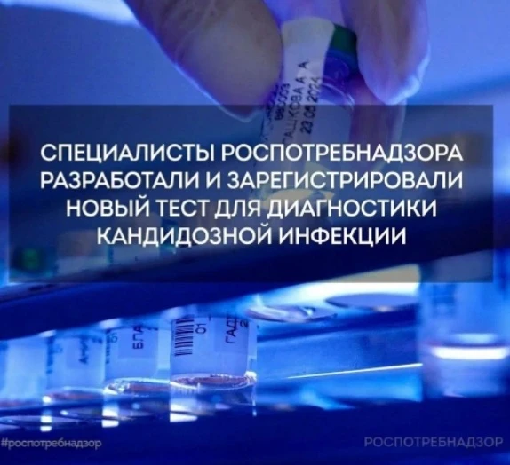 Ученые ЦНИИ Эпидемиологии Роспотребнадзора разработали новый тест для количественного определения ДНК Candida - изображение