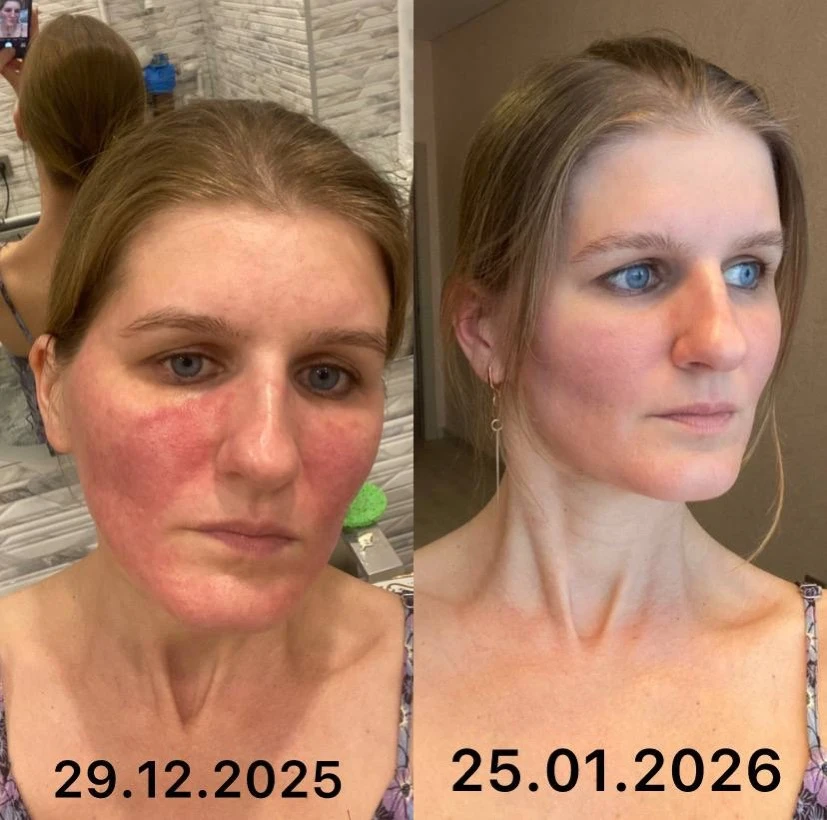 Удивительно? Нет. Это месяц клеточного питания Fitline​ #fitline - изображение