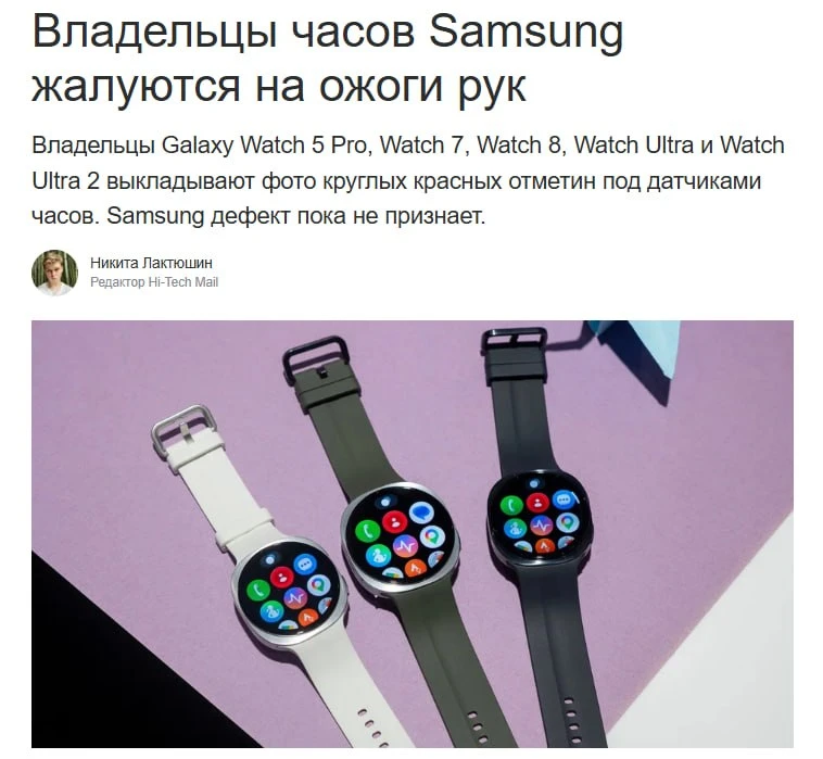 Что происходит: Пользователи Samsung Galaxy Watch массово жалуются на ожоги и следы на запястьях прямо под - изображение